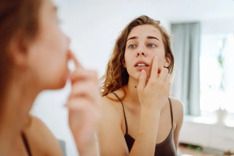 Nahaufnahme einer jungen Frau, die ihre Pickel im Gesicht betrachtet